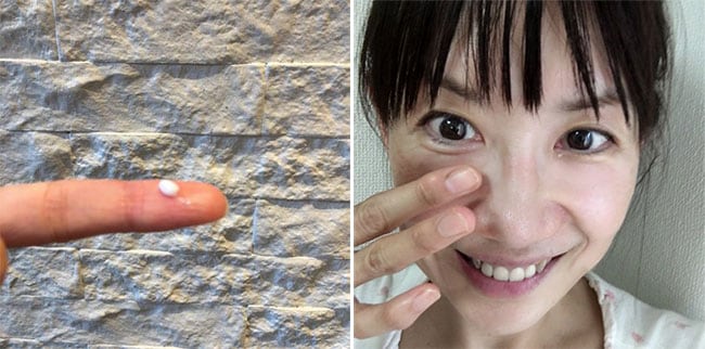 つけているうちに、目がパッチリと開くようになりました。感激！