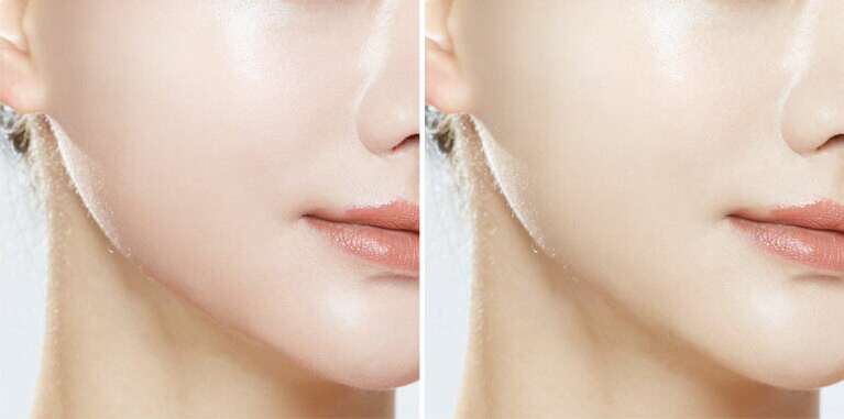 写真左から、ピンクを塗布した肌とホワイトを塗布した肌のイメージ。ピンクは健康的であたたかみがある印象、ホワイトは光が集まって透明感の高い印象に。