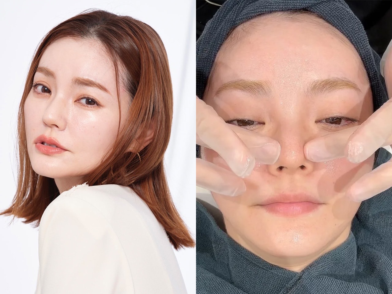 奇跡の44歳・藤井明子さんに聞く、おすすめ美容医療ガイド。