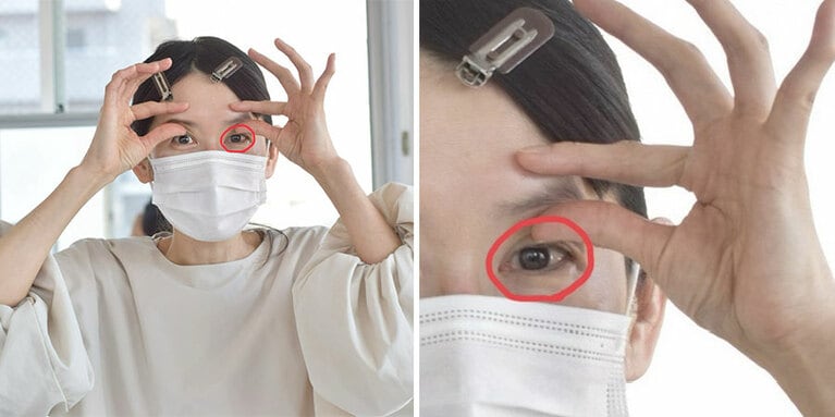 アイホール（右写真の赤で囲った場所）の上の部分の骨をとらえる。