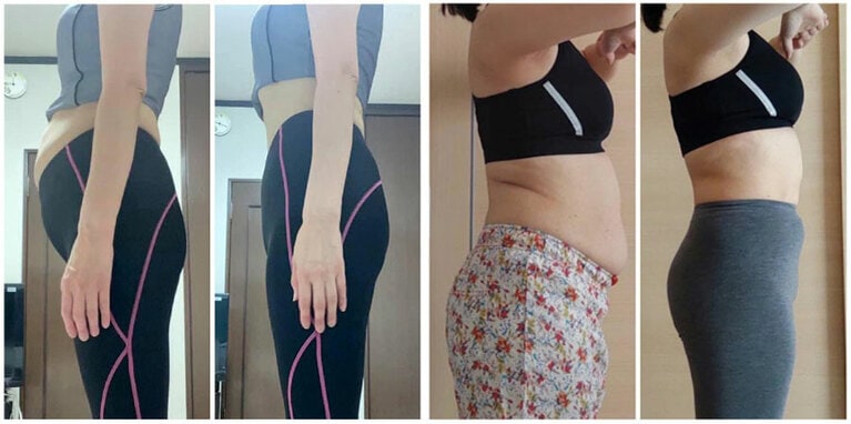 体験者たちの実績。左は54歳女性、右は43歳女性。いずれも、右が2カ月後。「なんとかしたい」お腹周りが、こんなにもスッキリ！