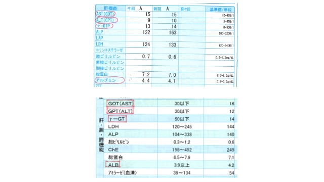 血液検査で見たいのはこの4つ。なかでも、脂肪肝で気に留めるべき項目はALT(GPT)。画像は見本として、担当編集の健康診断時のものから該当箇所を抜粋したもの。