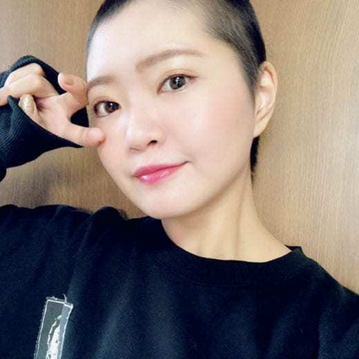 抗がん剤治療が終わり、髪の毛が少しずつ生えてきた頃。