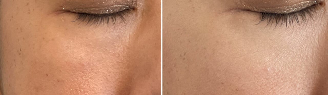 “昭和二桁ババア”編集部員もお試し。左がビフォー、右がアフター。目の下のクマが薄くなっている。また、まさにフィルターをかけたように全体が明るくなり、肌のあらが目立たないように。