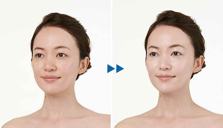 メイクアップ効果による仕上がりのイメージ before→after。