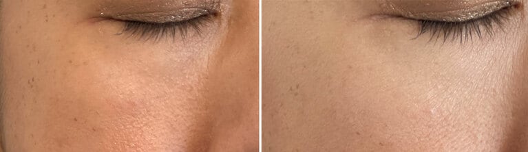 “昭和二桁ババア”編集部員もお試し。左がビフォー、右がアフター。目の下のクマが薄くなっている。また、まさにフィルターをかけたように全体が明るくなり、肌のあらが目立たないように。