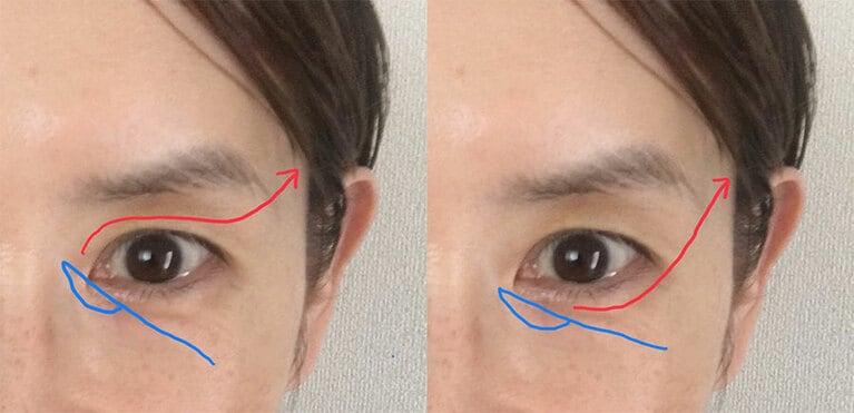 ケアすべき範囲を詳しくご紹介します！