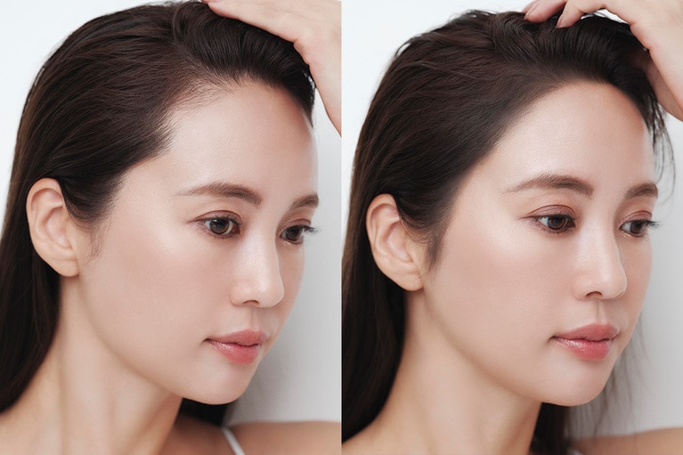 サイドの薄く見える部分、ラインのガタつきを自然にカバーして小顔に。左が塗る前、右が塗った後。