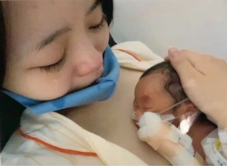 1990グラムで男の子を出産。その後、すぐに子宮の摘出手術を行った