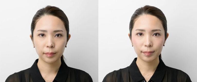 左がチークメイク前、右がチークメイク後。顔全体がリフトアップした印象に。