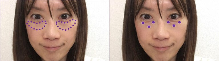 左の写真のように伸ばすため、右写真のように点で置いていく。