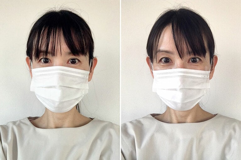 左がビフォー、右がアフターです。ノーメイクなのでマスクしたままです。