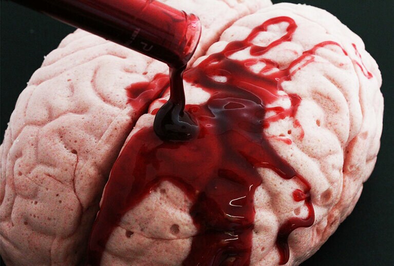 脳みそマシュマロ(ストロベリー) 5,537円(オプションの血のソース 278円)／キャンディアートミュージアム by PAPABUBBLE