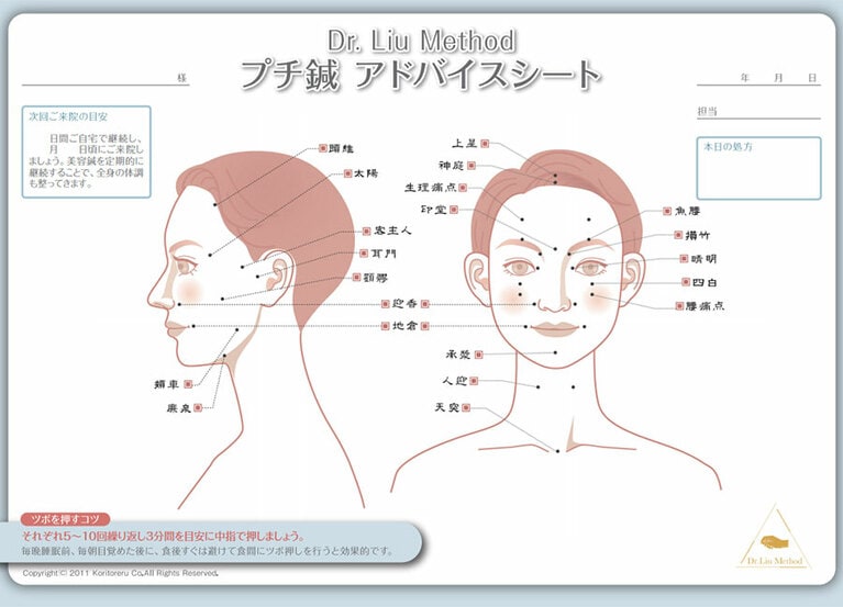 オススメのツボの位置が記入された「プチ鍼 アドバイスシート」(提供：HARI-UP)。