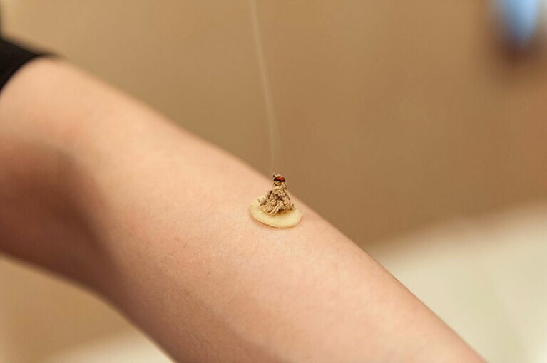 スライスした生姜にもぐさをのせた「生姜灸」。じんわりと体を温める。