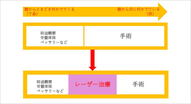 骨盤臓器脱は、これまでは経過観察か骨盤体操、ペッサリー挿入、手術しか治療法の選択肢がなかったそう。