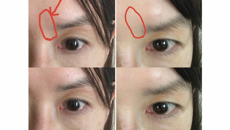 左がビフォー、右がアフター。縦ジワが消えただけでなく、額も滑らかになりました。