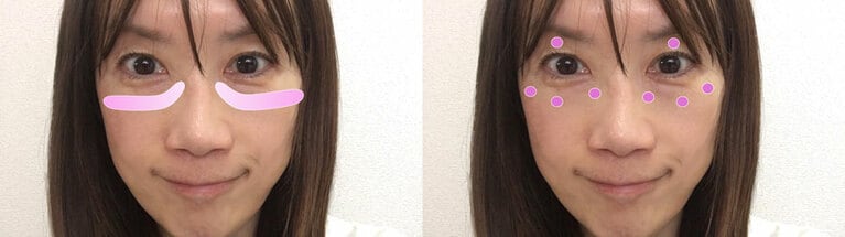 左写真のように伸ばすため、右写真のように点で置いていく。