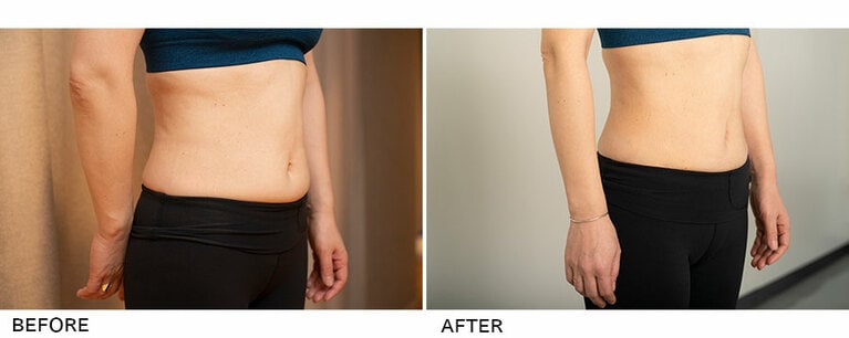 体重 52.9kg／体脂肪率 28.5％／ウエスト 66cm → 体重 47.8㎏／体脂肪率 26.7％／ウエスト 62cm