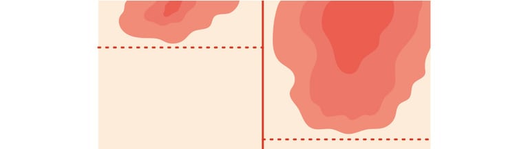 
左：塗るケア、右：針で注入
