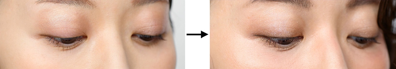 写真左から、BERORE画像、AFTER画像。