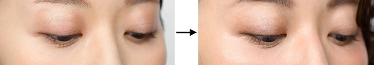 写真左から、BERORE画像、AFTER画像。