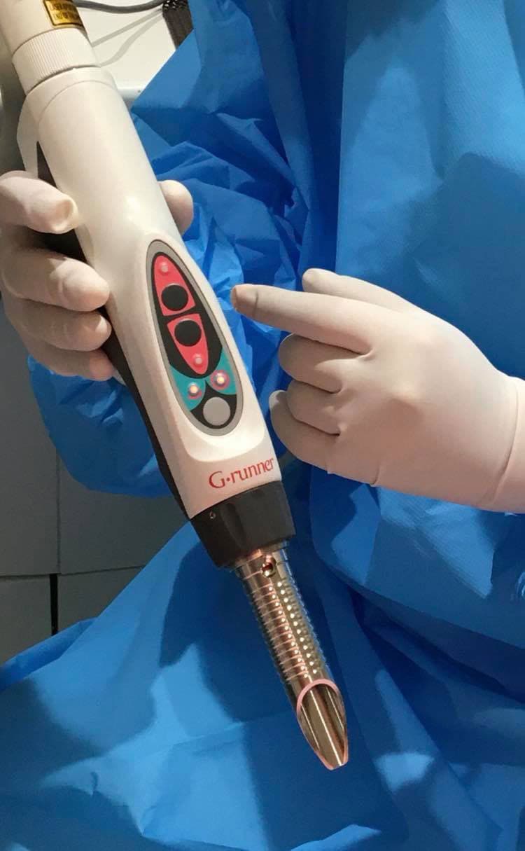 先端の空洞部分からレーザーが照射されます。