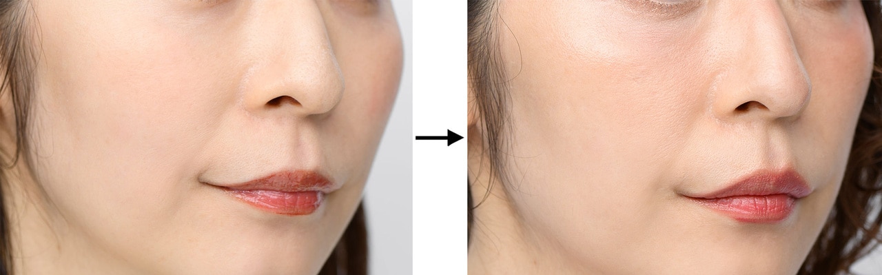 写真左から、BERORE画像、AFTER画像。