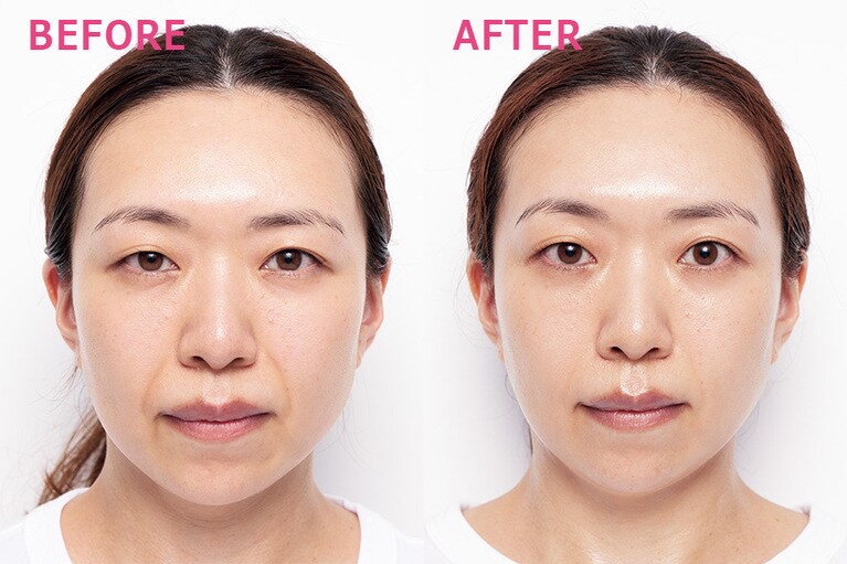 『スキンケアで肌を毎日いためていませんか？ こすらなければ、美肌』収録の美肌メソッド「肌アイロン」と「ほうれい線ほぐし」を続けた結果、目が開いてぱっちりし、ほうれい線も薄く短く目立たなくなった（写真右）。