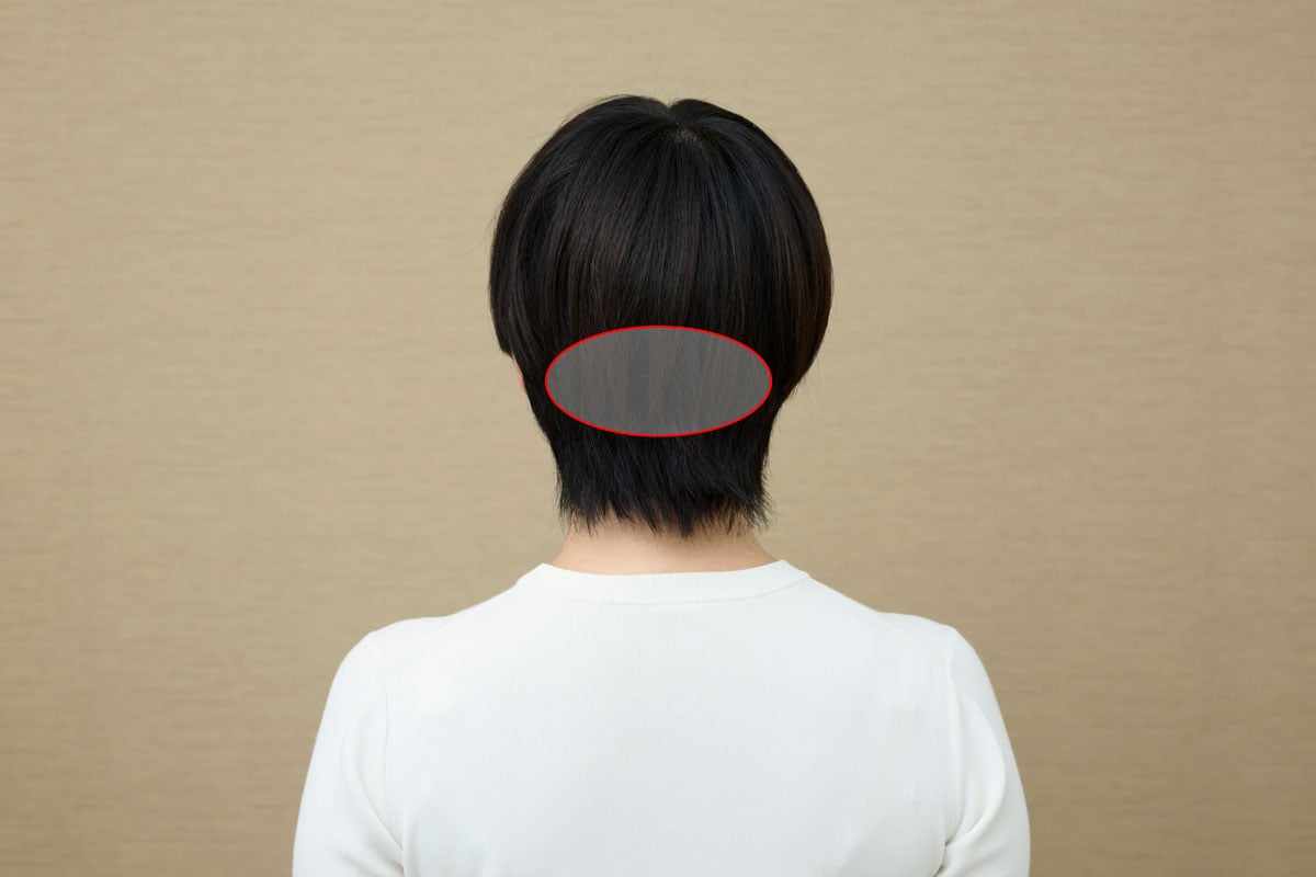 あご周りのたるみの元凶になっているのは後頭部のこのエリア。固くなってしまった筋肉をほぐすマッサージが必要。