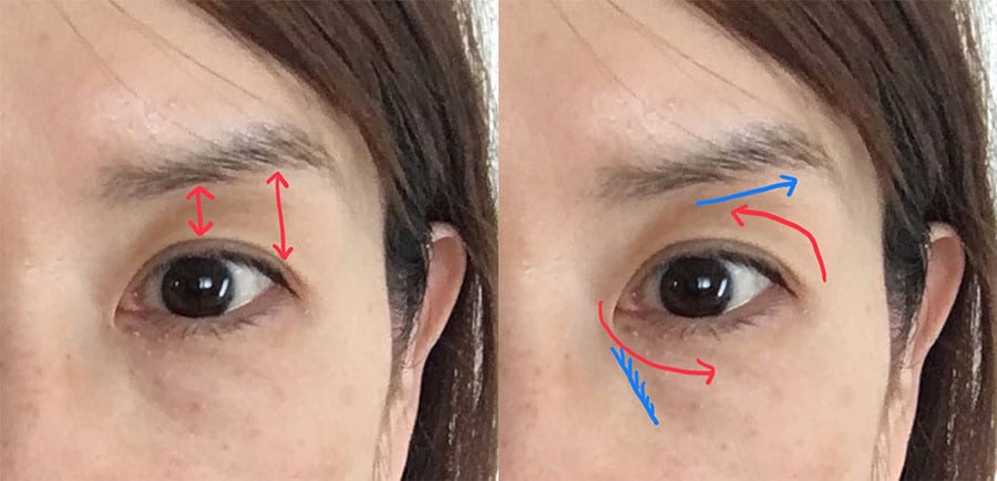 眉下が本来よりも長い。右写真の青線が今の悩みの「線」なのですが、赤線のように筋肉を動かせれば、距離が縮まり線が消えると思うのです。