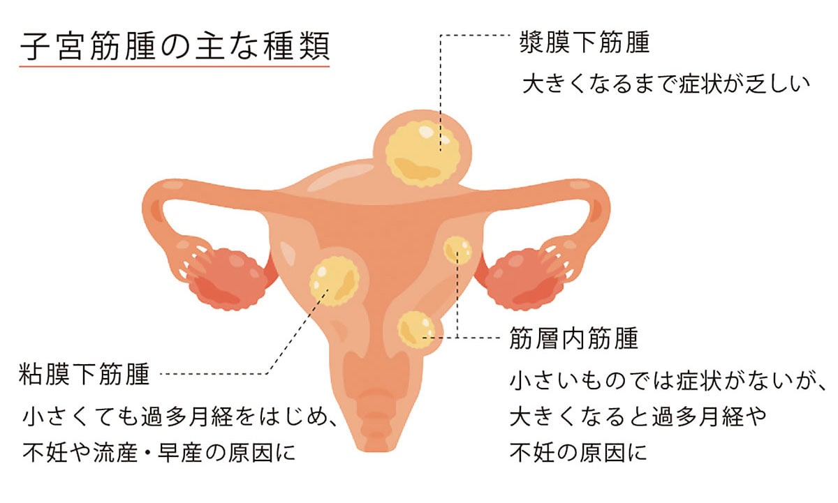 画像提供：yurumarukko/イメージマート