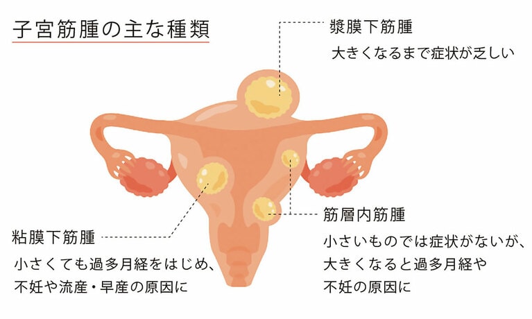 画像提供：yurumarukko/イメージマート