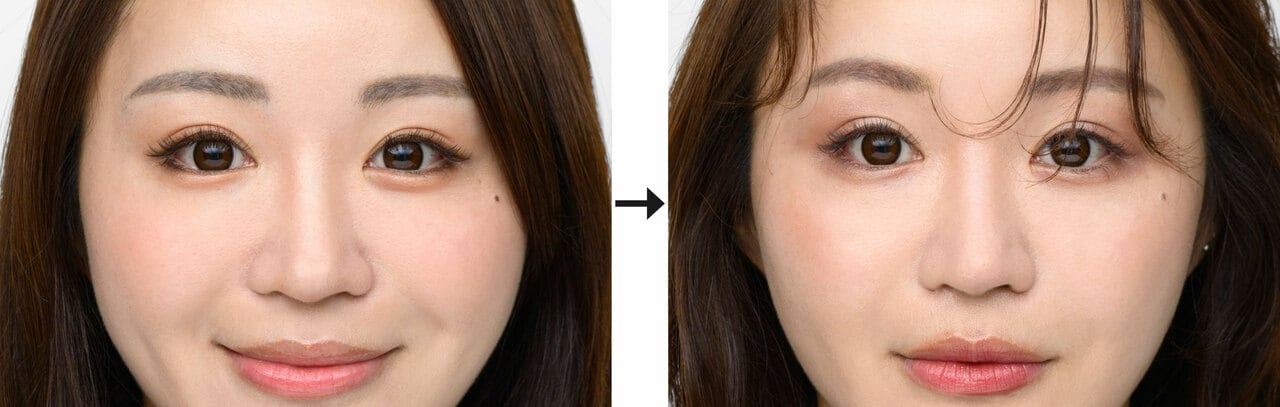 写真左から、BERORE画像、AFTER画像。目まわりに抜け感が出て、今っぽい雰囲気に。