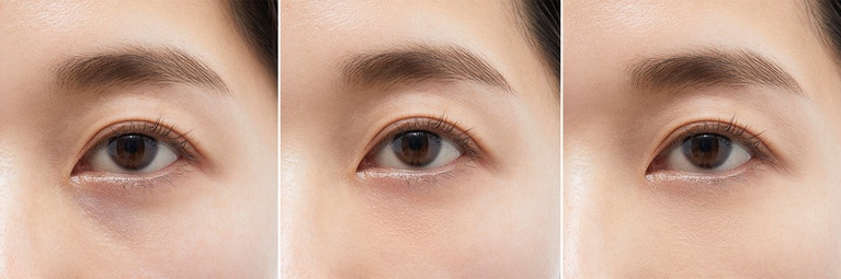 左から、青クマの人のBefore→オレンジコーラルのみ使用→オレンジコーラルとベージュを使用。