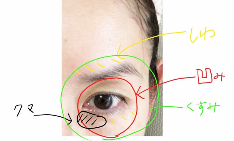 私のダメージレベルです。要ケア要素が満載ですが、せめて凹みは直したい……。
