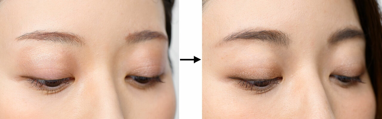 写真左から、BERORE画像、AFTER画像。