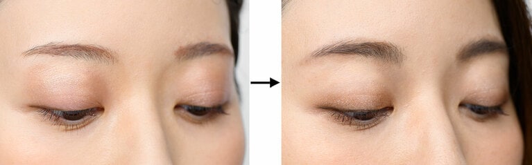 写真左から、BERORE画像、AFTER画像。