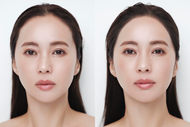 パフで軽くパウダーを重ねるだけで、おでこのうぶ毛が多い部分がカバーされ、ラインも修正され、引きで見た時に引き締まった印象に。左が塗る前、右が塗った後。