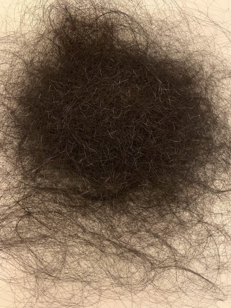 治療を開始して4、5日たった頃に抜け落ちた髪の毛。髪を乾かした時に抜けた一回分。