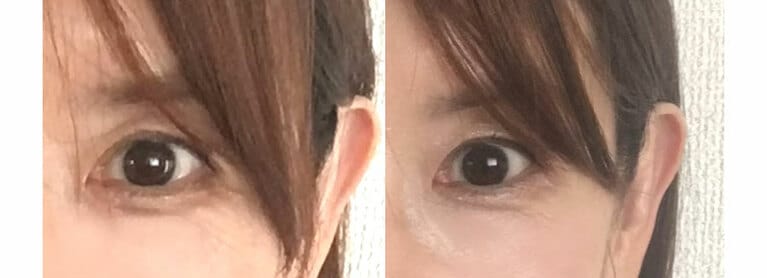 左からパターン1、パターン2です。