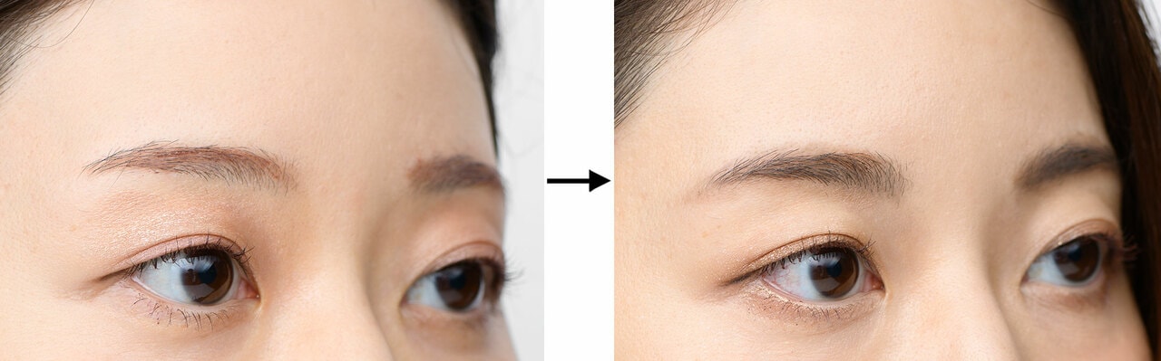 写真左から、BERORE画像、AFTER画像。