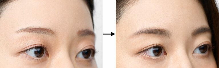 写真左から、BERORE画像、AFTER画像。