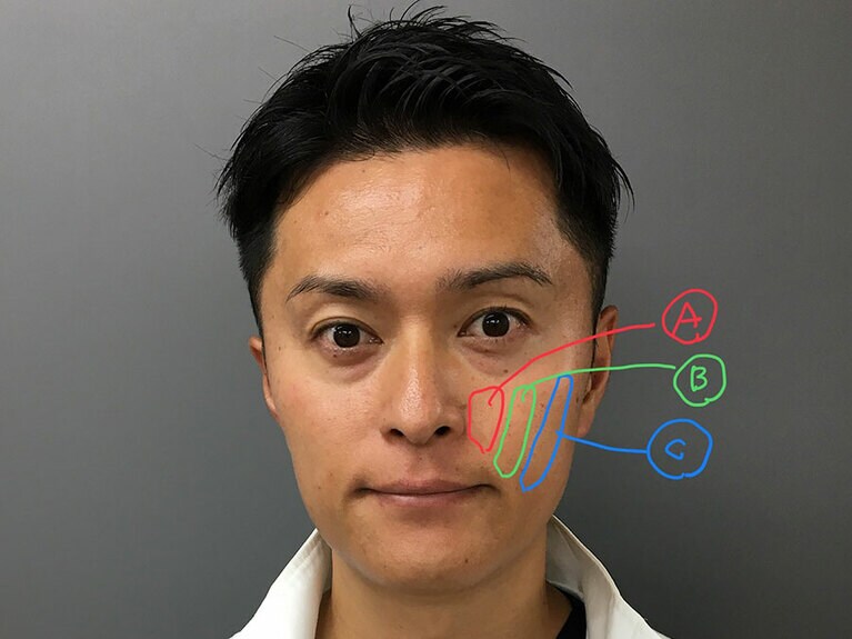 Aが上唇挙筋、Bが小頬骨筋、Cが大頬骨筋。全て口輪筋から頬に向かって伸びている。