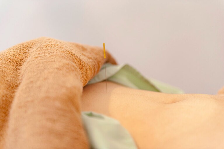 ファスティングを鍼でサポートしながら胃腸の疲れを取る。