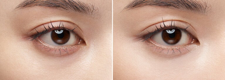 ケイト　ジュレリープコンシーラー 01 淡月の使用前（写真左）と使用後（写真右）。