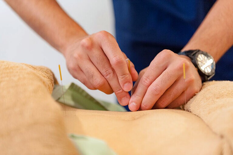 太い鍼でも痛みを感じないのは高い技術の賜物。