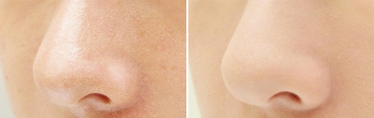 左が塗る前、右が塗った後。加工アプリ級の毛穴ぼかし力！　すりガラスやシャーベットみたいなハーフマットな質感に。