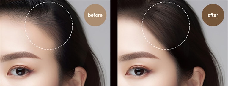 生え際の余白をうまく自然にカバーすると、小顔にも見えるし若々しくも見える。