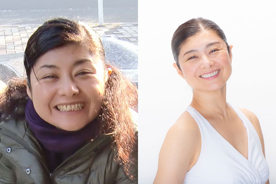 【ビフォー写真】左:10年前の38歳頃の間々田先生。【アフター写真】右:現在。「大頬骨筋」が引き締まって輪郭が変わっています。